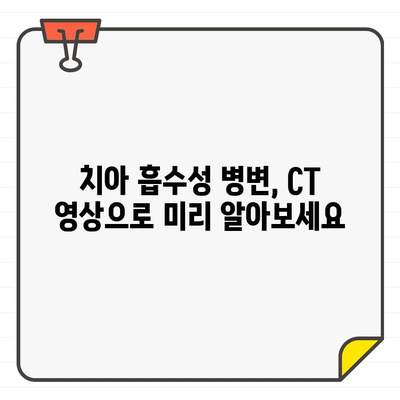 치아 흡수성 병변 진단, CT 영상으로 정확하게 | 치과, 영상 진단, 흡수성 병변