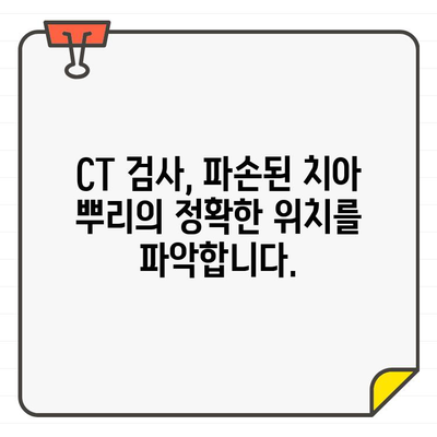 치아 뿌리 파손, CT 검사가 왜 중요할까요? | 치아 뿌리 파손 진단, CT 활용, 치과 치료