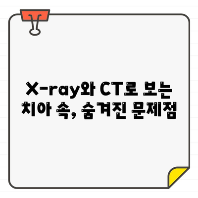 X-ray와 CT를 활용한 치과 질환 정확한 진단 | 치과 질환, 진단, 영상 진단, X-ray, CT