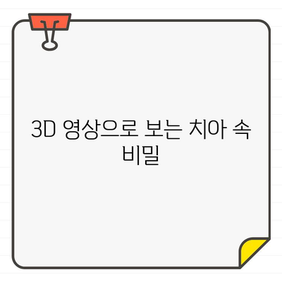 치과 진단의 새로운 지평, CT 촬영의 활용 | 치과, 3D 영상, 정확한 진단, 치료 계획