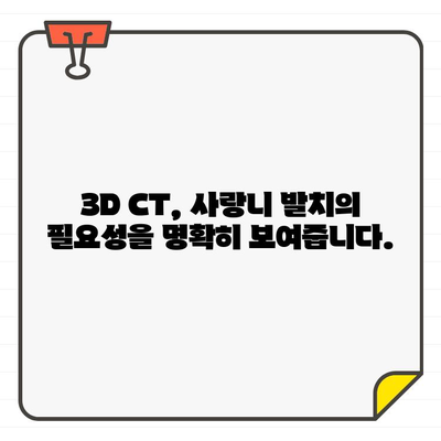 3차원 CT 진단 기반 사랑니 발치 결정| 근거와 필요성 | 사랑니, 발치, 3D CT, 치과, 진단