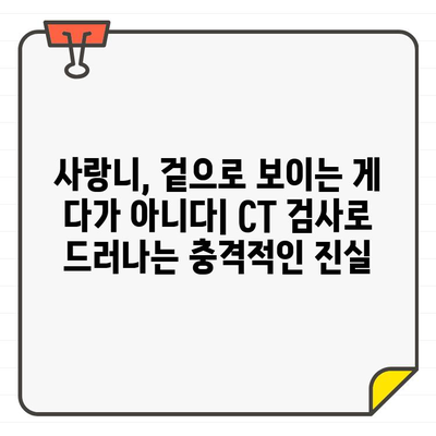 CT로 본 사랑니의 충격적 진실| 숨겨진 위험과 치료 가이드 | 사랑니, CT 검사, 발치, 통증, 치과