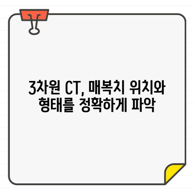 매복치 진단의 정확성을 높이는 동작구 교정 치과의 3차원 CT 활용 | 매복치, 3차원 CT, 교정 치과, 동작구