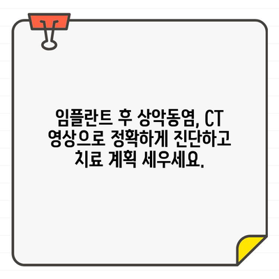 임플란트 후 상악동염, 치과 CT로 해결 가능할까요? | 상악동염, 임플란트, 치과 CT, 진단, 치료