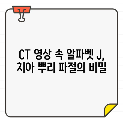 치아 뿌리 파절 진단| CT 영상에서 알파벳 J 모양이 숨겨진 비밀 | 치아 뿌리 파절, CT 진단, 알파벳 J, 치과