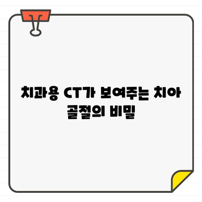 치과용 CT 활용, 치아 골절 정확하게 진단하고 치료하세요 | 치아 골절, 치과용 CT, 진단, 치료, 정보