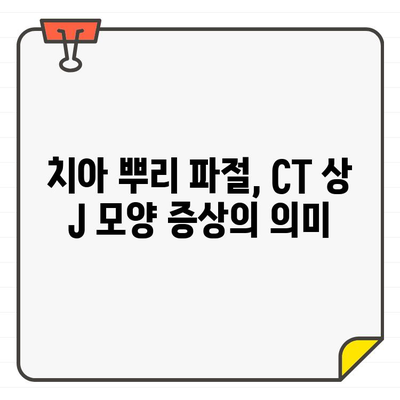 성내동 길동 치과, 치아 뿌리 파절 진단 CT 상 