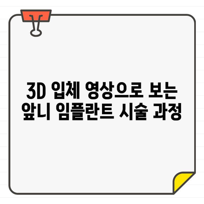 공덕역치과, 디지털 CT로 앞니 임플란트의 정교함을 가시화하다 | 임플란트, 디지털 치과, 공덕역