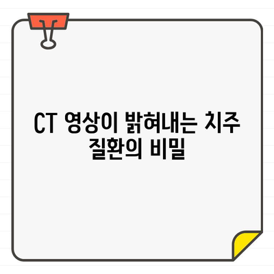 CT 영상으로 밝혀낸 숨겨진 구조와 치주 질환의 연관성 | 치주 질환, CT, 구조, 진단, 치료